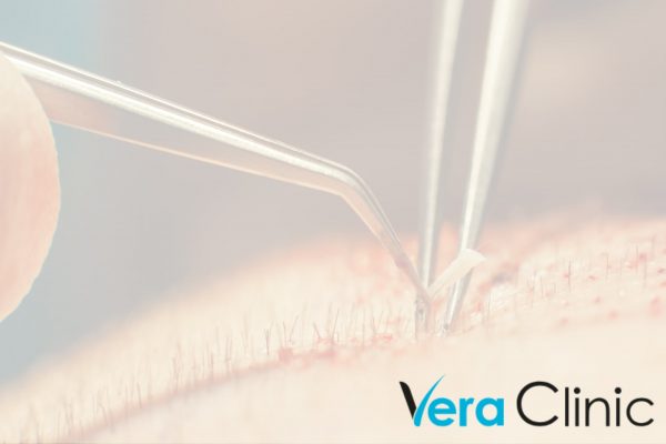 How Much Does Hair Surgery Cost In Turkey? Vera Clinic Logo